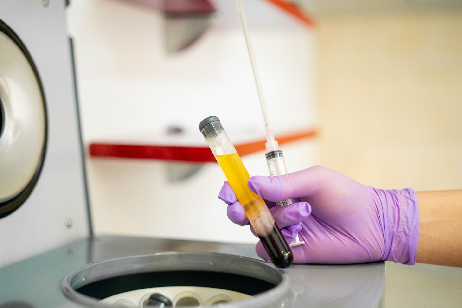 Preparing blood plasma for vampire treatment